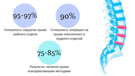 Лечение позвоночника в Израиле